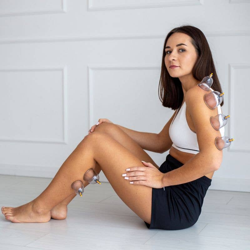 Acus Med kuppaussetti 20 kpl – tehokas ja turvallinen lihashuolto