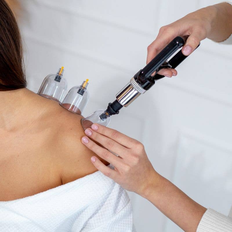 Acus Med kuppaussetti 20 kpl – tehokas ja turvallinen lihashuolto